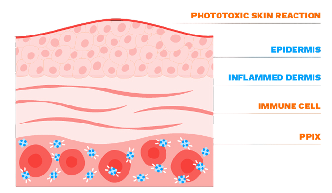 PPIX-induced phototoxicity
