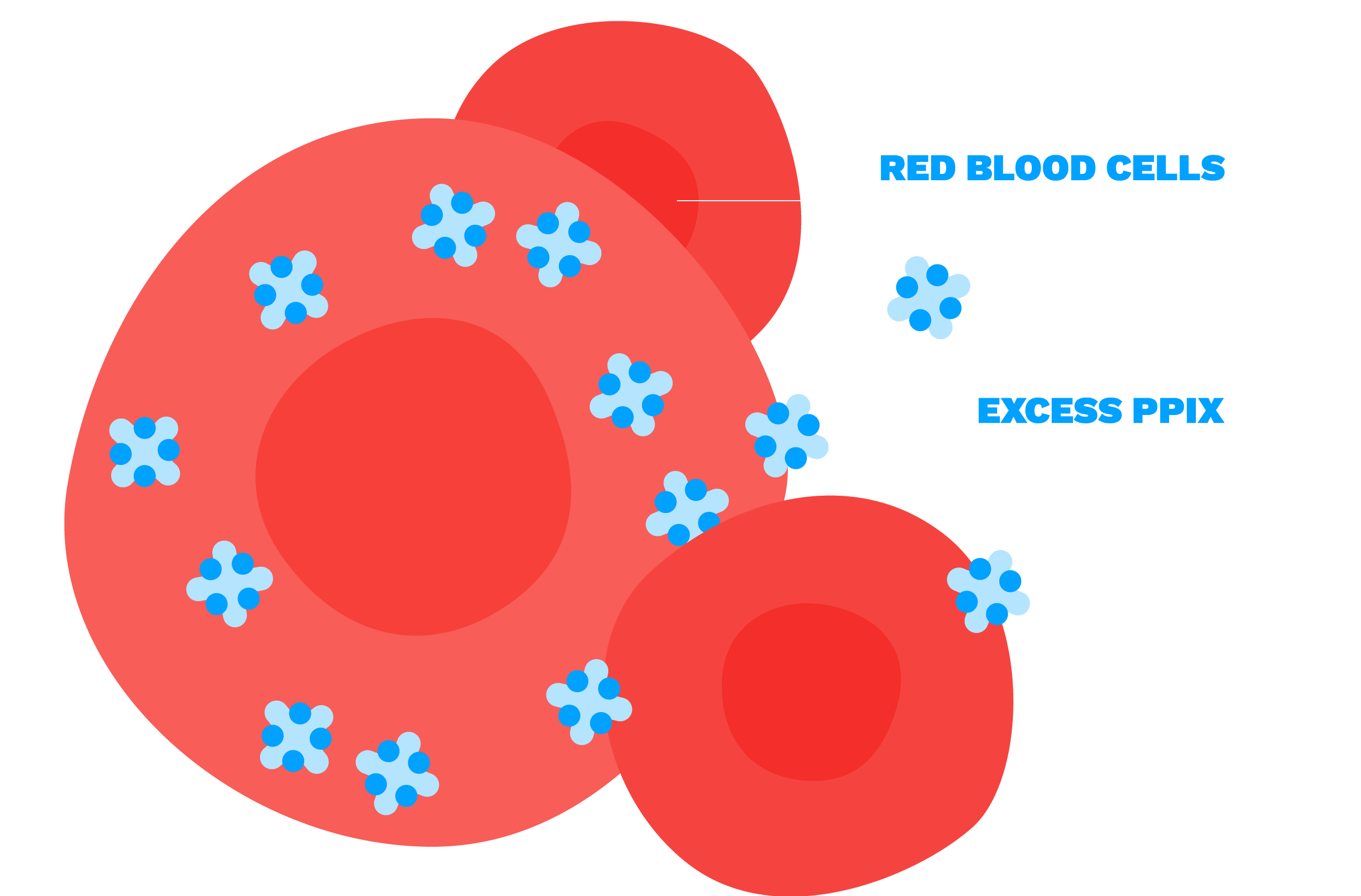 Systemic PPIX accumulation
