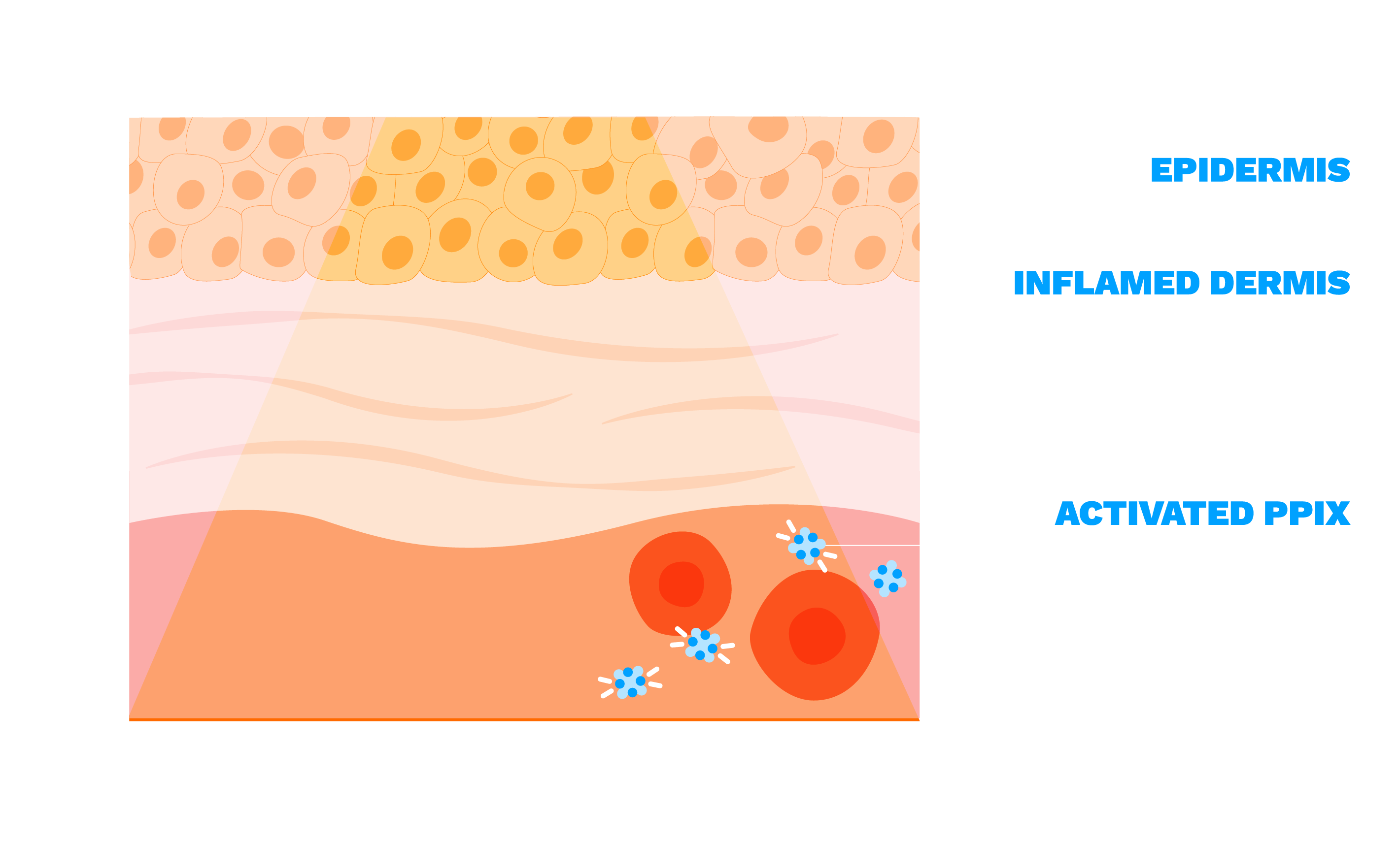 Light-triggered PPIX activation