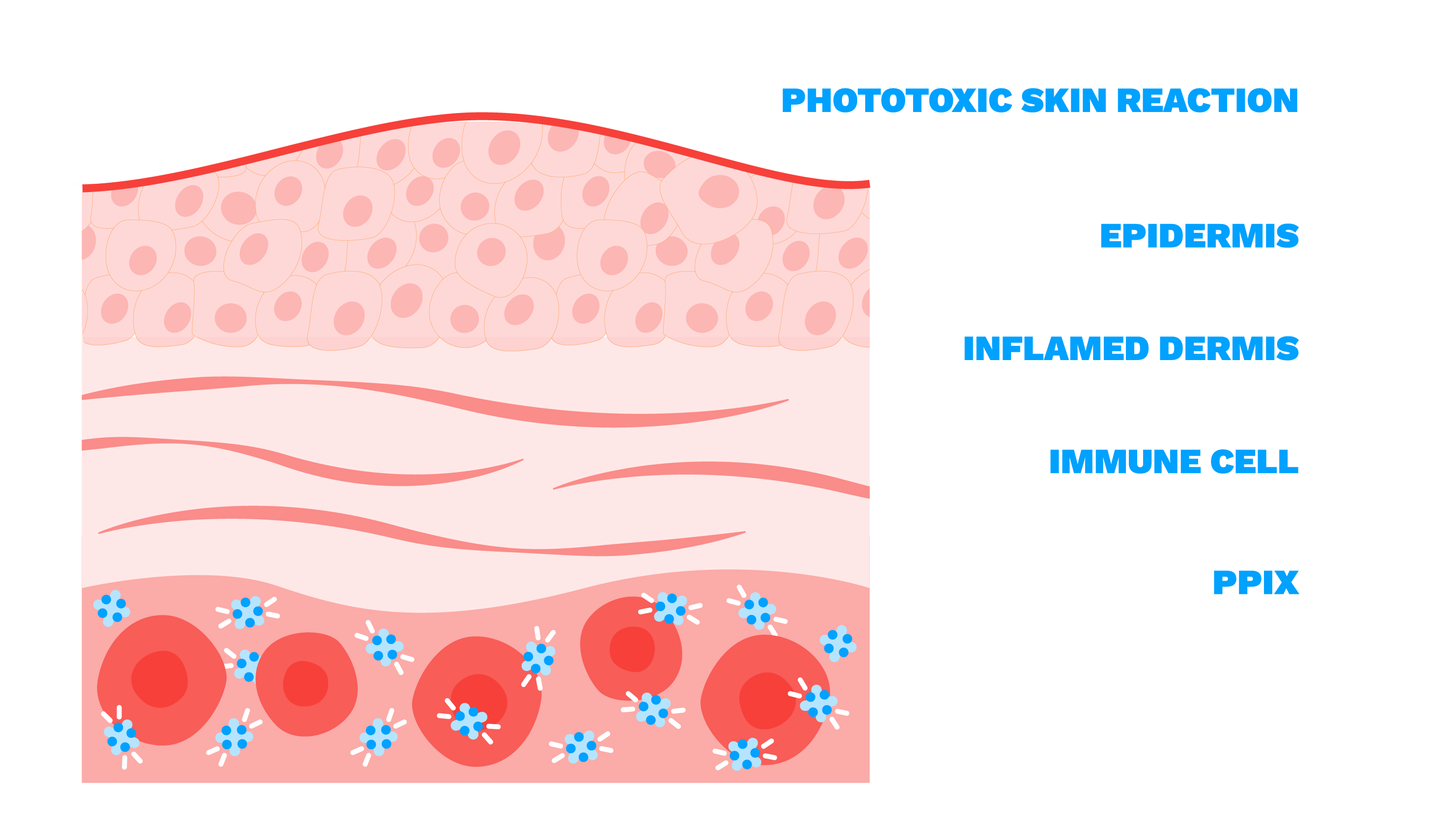 PPIX-induced phototoxicity