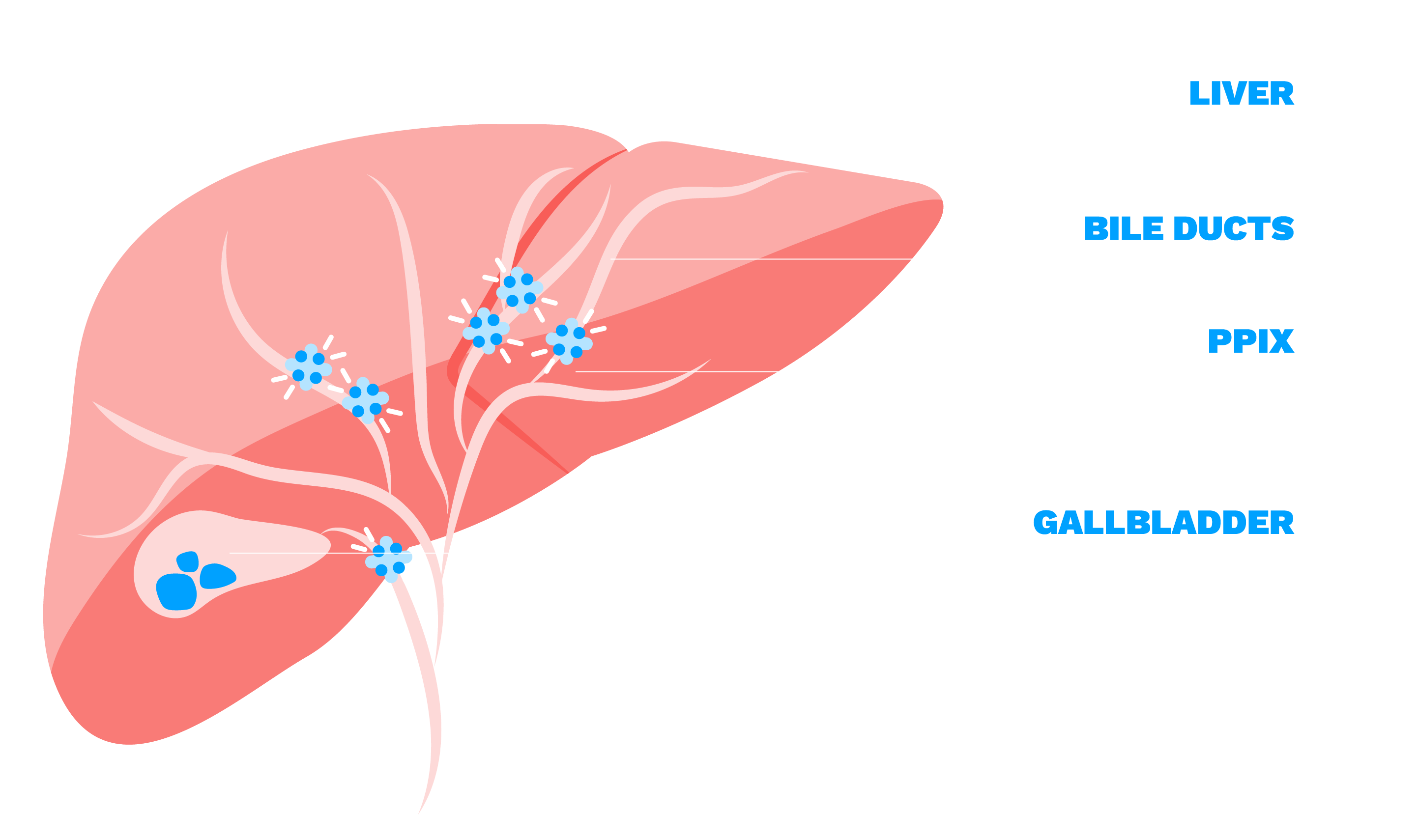 PPIX-induced phototoxicity